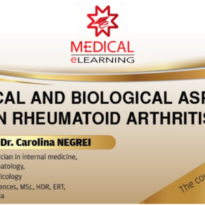 Clinical and Biological Aspects in Rheumatoid Arthritis